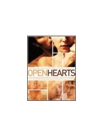 Open hearts 